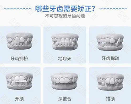 荆门小白兔牙科最新价目表解析：种植牙、牙齿矫正及补牙等收费标准详解(图1)