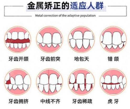 河源人民医院口腔科服务全面解析：牙齿矫正费用多少，价目表一览，价格是否合理？