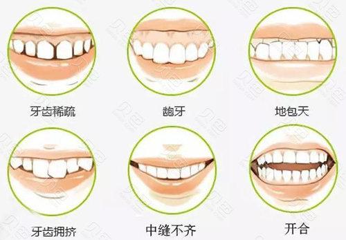 阜阳颍州贝德口腔门诊部口碑怎么样？参考费用分享！