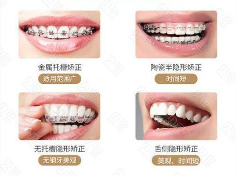 南阳市口腔医院正颌手术价格是多少？附价格标准、医院资料