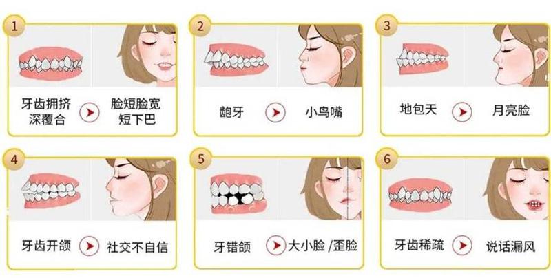 深圳牙力仕口腔价格表一览：看牙费用多少，正规靠谱且