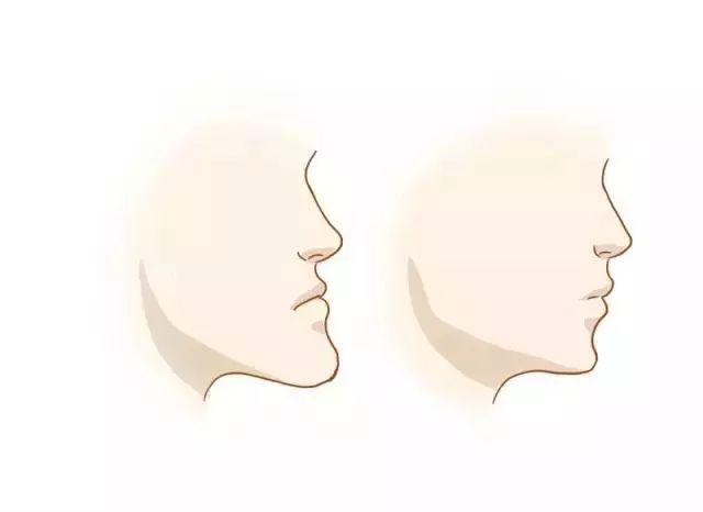贵阳美莱口腔正畸技术怎么样？陈燕医生正畸技术的5大优势你要知道！