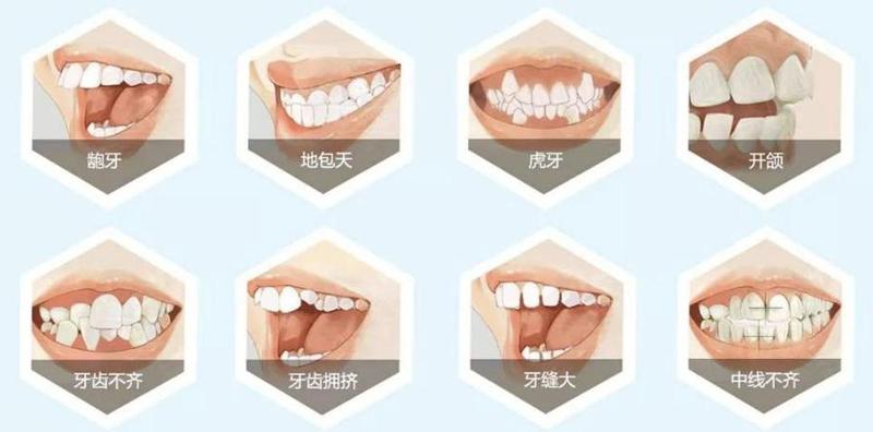 华山口腔诊所口碑如何？技术好吗？求美者分享真实体验(图1)