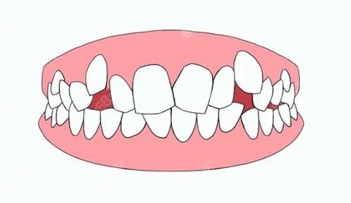 福州牙齿矫正医院怎么样？内含价格表及案例分析