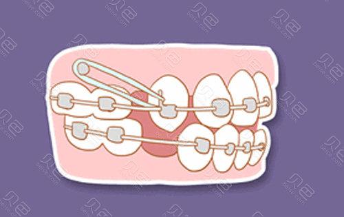 平江致远口腔收费标准揭秘：种植牙、牙齿矫正费用多少？价格表一览