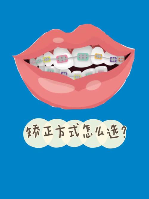 檀溪店时代口腔门诊金凤怎么样？附牙齿矫正案例展示