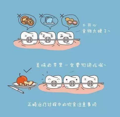 贵阳弘扬口腔看牙好吗？附看牙案例+特色项目介绍