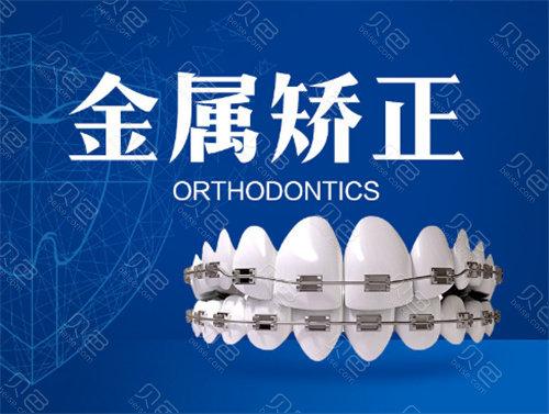 成都格林口腔口碑如何？技术与服务评价解析，看牙齿矫正经历分享(图1)