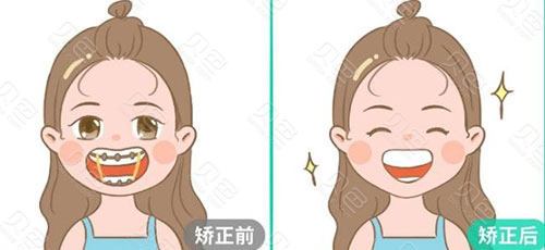 温州口腔医院口碑如何？技术好吗？一站式看牙体验怎么样？