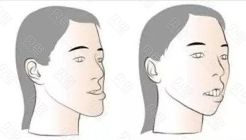 上海晟诺口腔怎么样？揭秘这家口腔诊所的优势与患者体验！