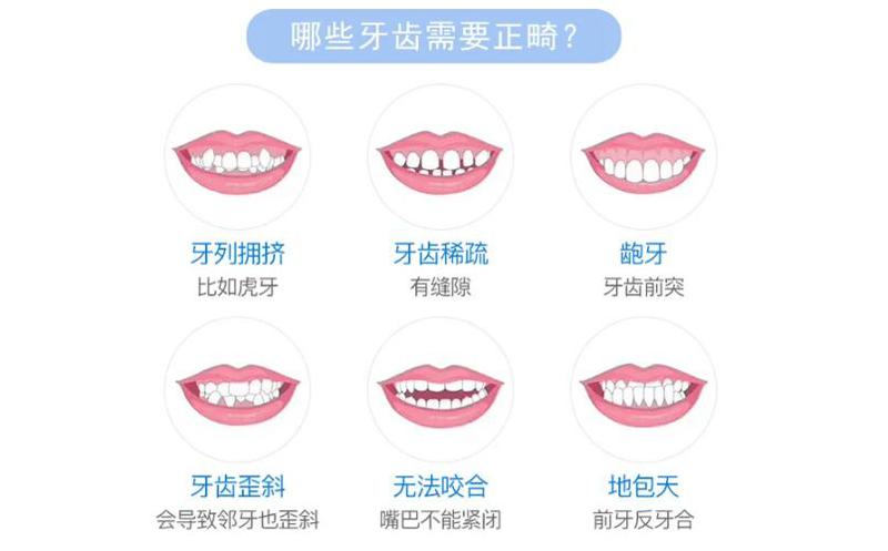 重庆牙科医院哪家好又便宜？星星口腔、贝尔口腔、茁悦口腔口碑上榜！