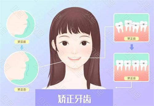 上海丽都口腔门诊部正不正规？牙齿矫正案例反馈真实，正畸知识科普+牙齿矫正价格参考