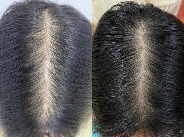 昆明植发医院怎么样，地址，价格