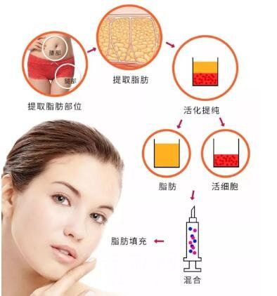 重庆美圣美邦抗衰整形怎么样？医院靠谱医生技术好