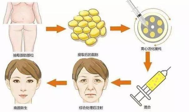 北京大脚骨手术哪个医院较好呢？这几家医院的知名度高，设备齐全！