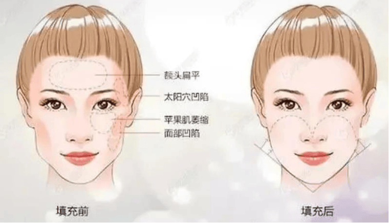 上海薇琳张怀军脂肪填充怎么样？个人简介、医院实力测评