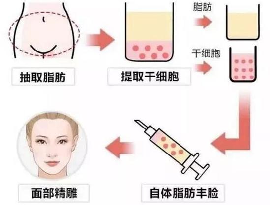 北京面部脂肪填充乔爱军好还是邱立东好？附医生简介。