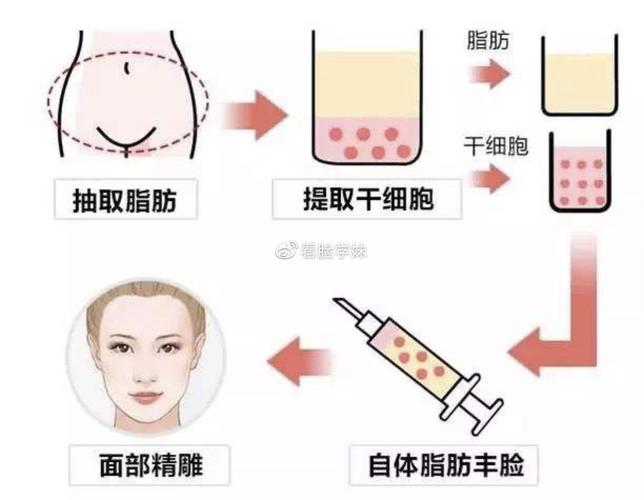 郑州美上美整形医院怎么样？医院有哪些特色项目？