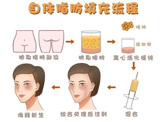 南昌美皇整形医院环境怎么样，南昌美皇整形医院医生技术好吗？