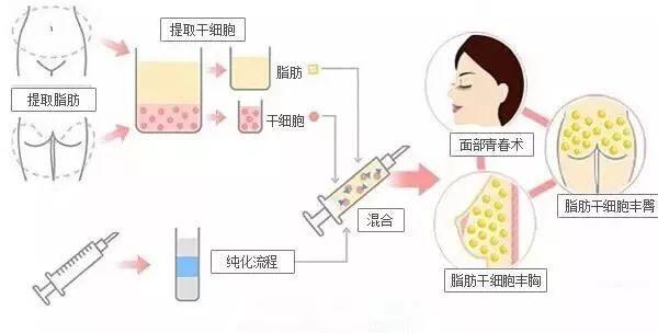 西安尤美医疗整形怎么样？医院介绍&医生介绍，一站式了解戳这里！