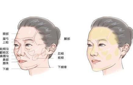 苏州整形哪家好？公布口碑好，专业性强的医院，请看这里！