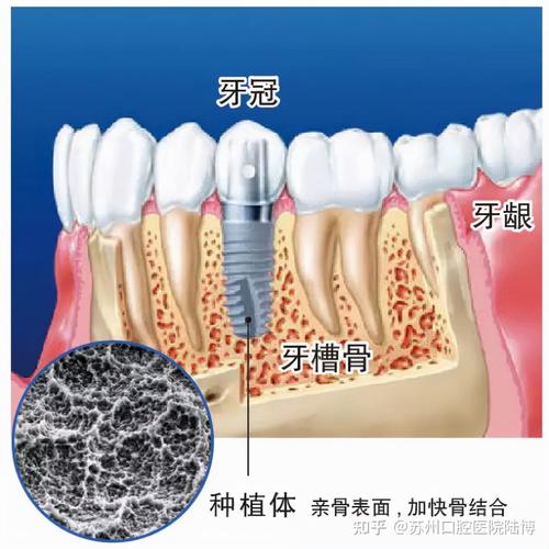 上海致浦口腔门诊部怎么样？都有哪些可靠医生值得信赖？