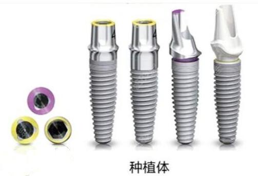 石家庄桥西区口腔医院口碑如何？技术好吗？看牙经历分
