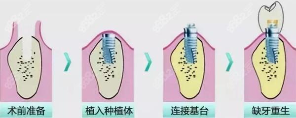 周口口腔医院是公立还是私立医院？都有哪些好的医生？