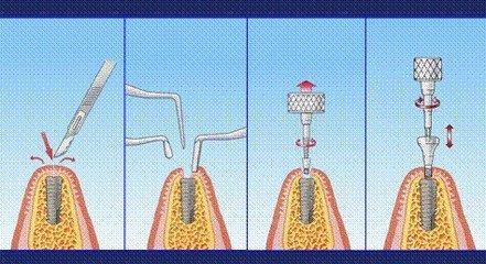 好牙依口腔医院怎么样？带您了解这个医院如何？案例分享(图1)
