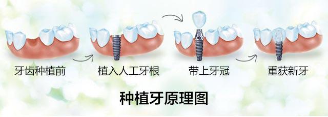 成都科瓦齿科公交路线及地址全攻略：看牙费用多少，交通价格表