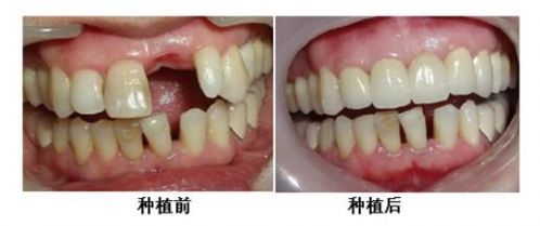 威海威高口腔门诊部怎么样？设备先进种植牙技术好！