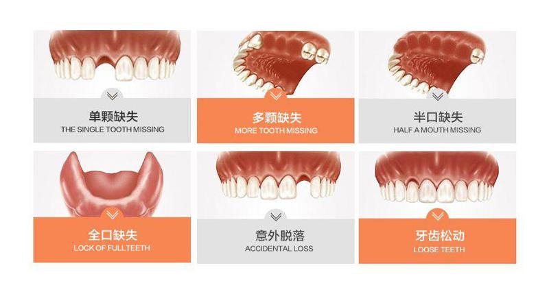 苏州英博口腔种植牙价格一览：费用多少，性价比高吗，收费表详细解读