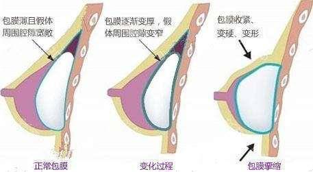 阜阳东方美莱坞医疗美容医院技术可靠吗？详细价格！速