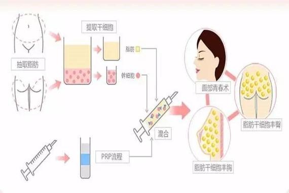 厦门莫琳娜是正规医院吗？多方面分析医院的正规性