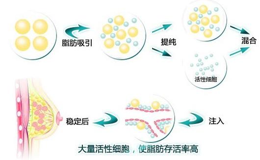 南宁梦想整形医院是正规医院吗？南宁梦想整形医院医生技术怎么样？