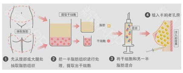 成都恒博医疗美容医院地址？成都恒博医疗美容医院医生技术好吗？