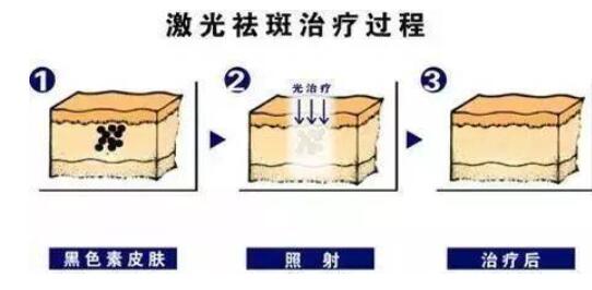 南宁市第二人民医院(口腔科)怎么样？牙齿矫正分享及口腔价格