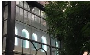 北京铂斐医疗美容诊所怎么样？全新价格表上线！附双眼皮案例分享！