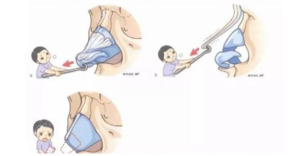 重庆美仑美奂做鼻修复靠谱吗?