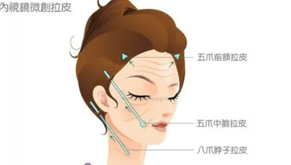 李彤彤(图3) 微信截图_20230329140904.png