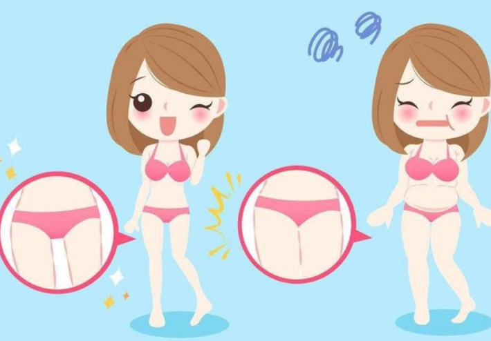 吸脂减肥