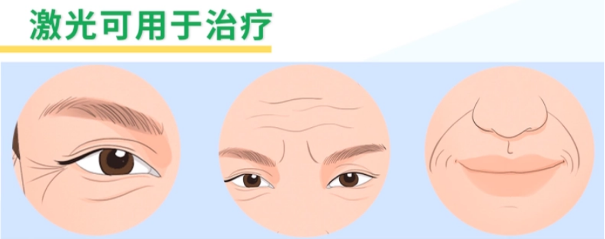 激光美容