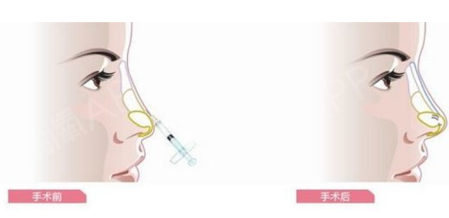 广州紫馨整形医院(图3) 微信截图_20230310114604.png