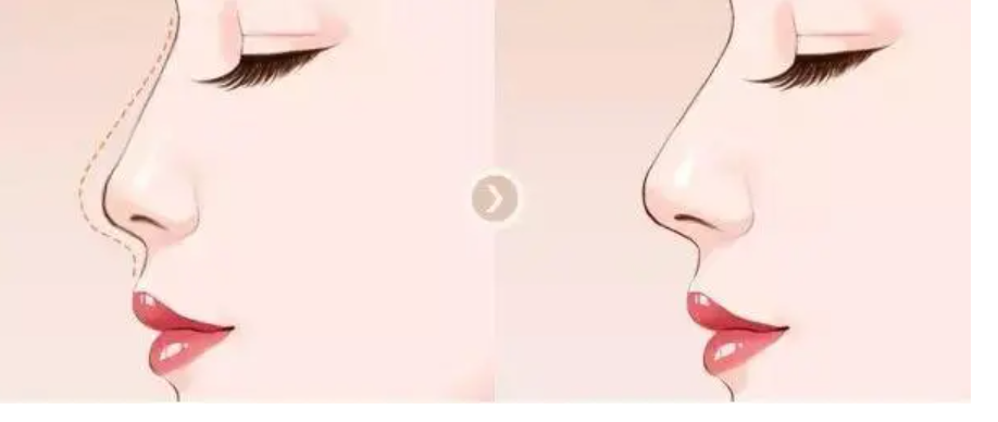 微信截图_20230405135954.png