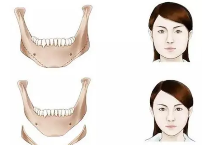 微信截图_20230405140210.png