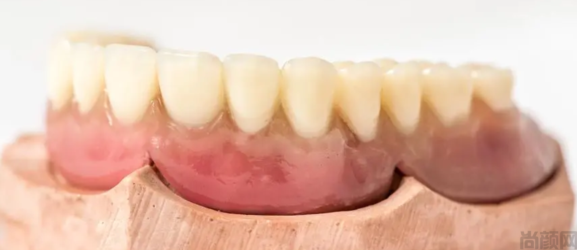 明星烤瓷牙是全拔吗?明星烤瓷牙的修复过程