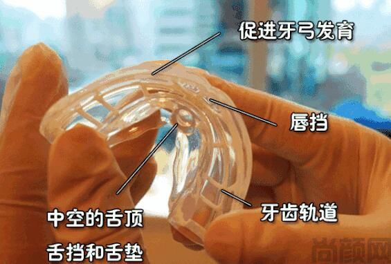 燕郊阳光树口腔医院(图2) mrc儿童早期干预矫正.jpg