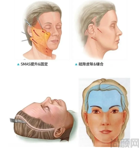 唐小龙(图3) 4 - 副本.png