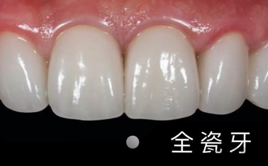 微信截图_20230412142258.png
