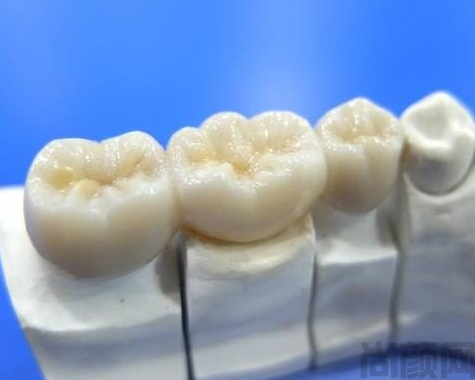800元一颗的全瓷牙是否真的是全瓷牙?